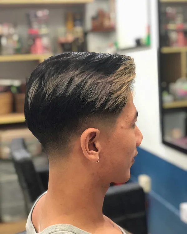 Uốn undercut